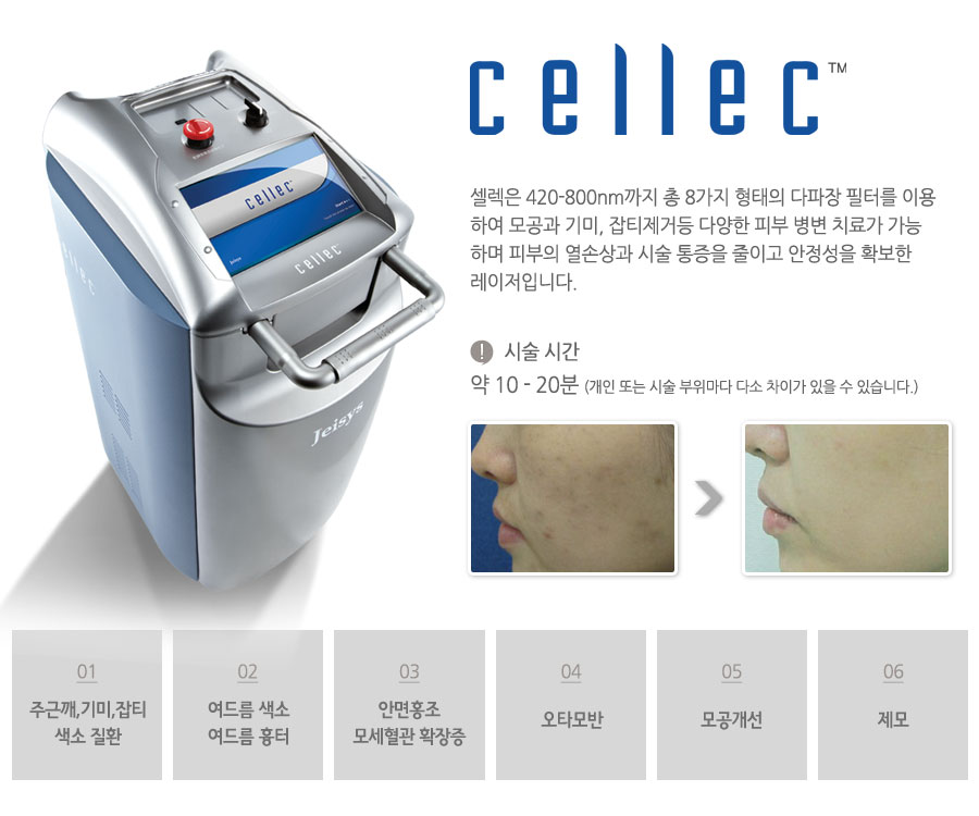 셀렉은 420-800nm까지 총 8가지 형태의 다파장 필터를 이용하여 모공과 기미, 잡티제거등 다양한 피부 병변 치료가 가능하며 피부의 열손상과 시술 통증을 줄이고 안정성을 확보한 레이저입니다.